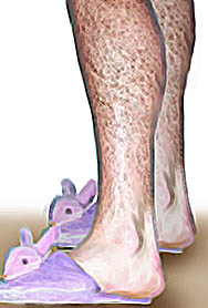 waxlegs.jpg